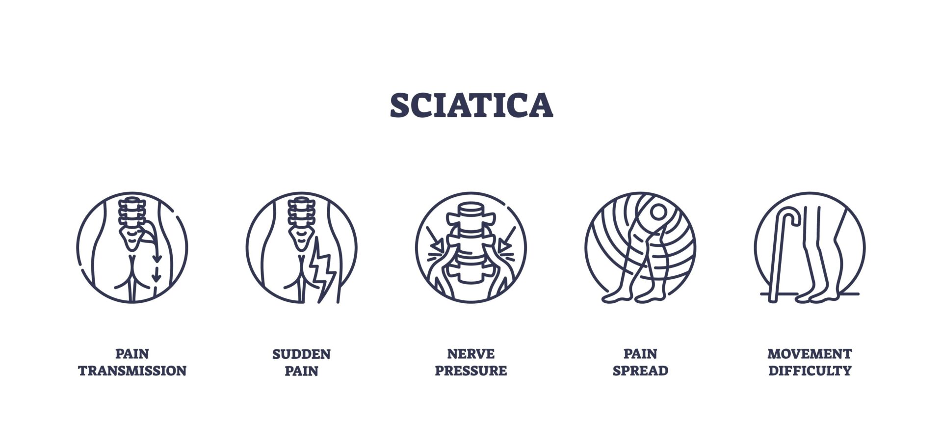 Sciatica symptoms