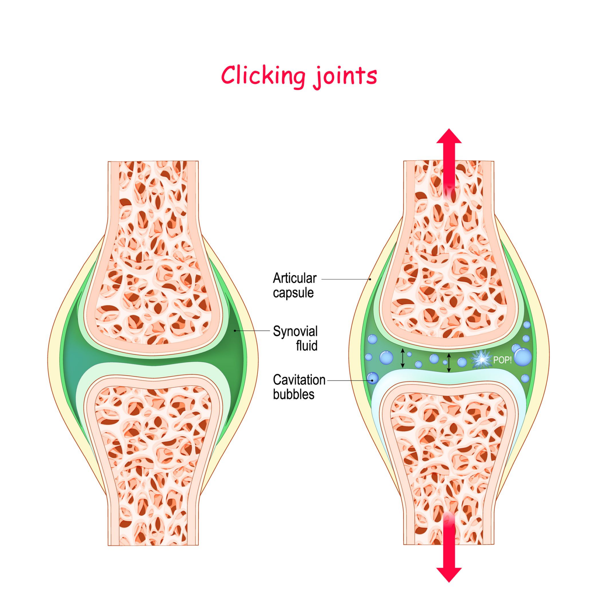 joint cavitation sound